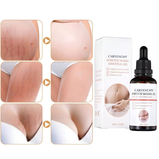 PerfectSkin - 30 ML Instant Stretch Mark Olie | 1+1 GRATIS