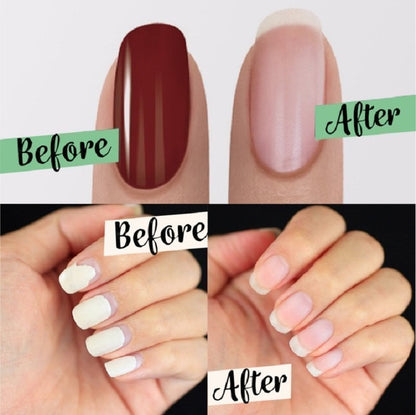 MagicRemove - Nagellakverwijderaar | 1+1 GRATIS