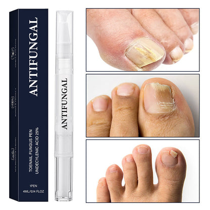 StrongNail – Precisie Nagelverzorging | 1+2 GRATIS