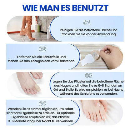 FungiPatch™ 60+60 stuks  – Discrete Behandeling van Schimmelnagels | 50% KORTING