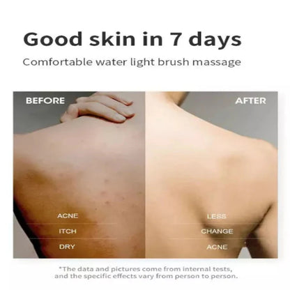 SkinSculptor Borstel — Onthul Stralende, Zijdezachte Huid