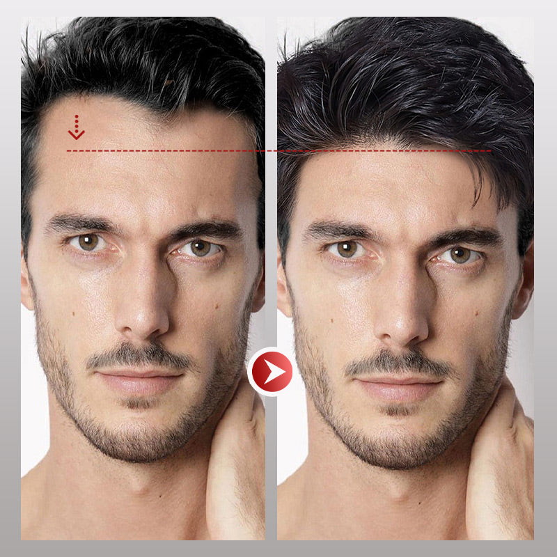 InvisiHair™ Heren Frontaal Haarstuk Directe Verlichting | 50% KORTING