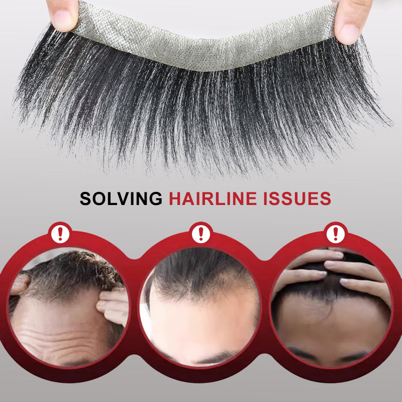 InvisiHair™ Heren Frontaal Haarstuk Directe Verlichting | 50% KORTING