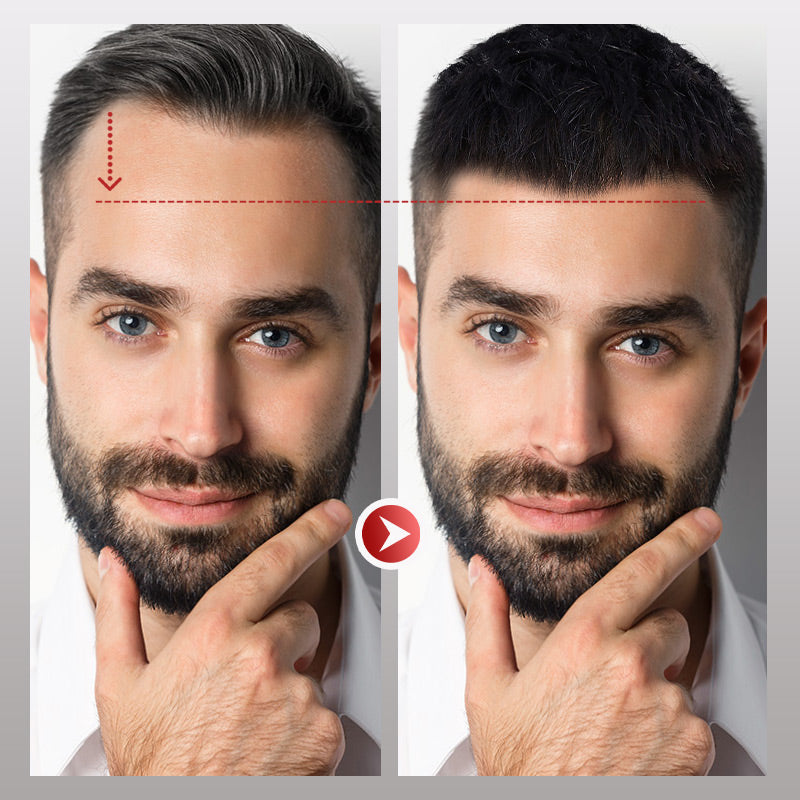 InvisiHair™ Heren Frontaal Haarstuk Directe Verlichting | 50% KORTING