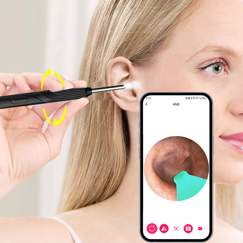 ClearScope™ Oorsmeerverwijderaar met HD-camera