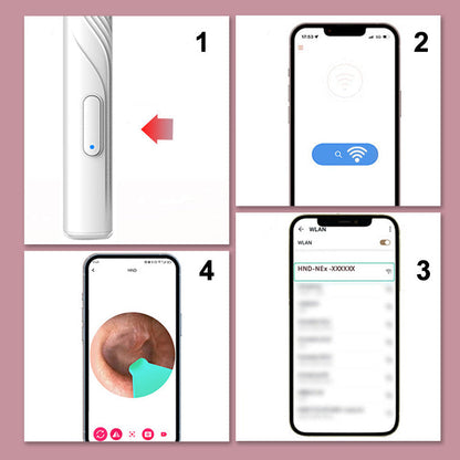 ClearScope™ Oorsmeerverwijderaar met HD-camera