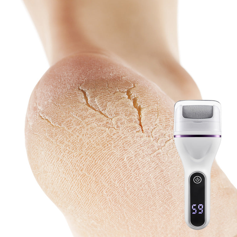 SmoothStep™ Elektrische eeltverwijderaar voor voeten - Zachte en effectieve eeltverwijdering overal