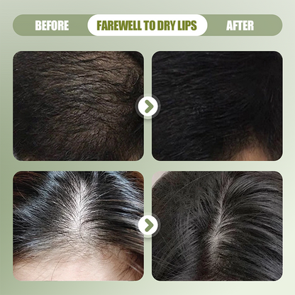 BotaniCare – Natuurlijke vaste shampoo | Koop 1, krijg 1 GRATIS